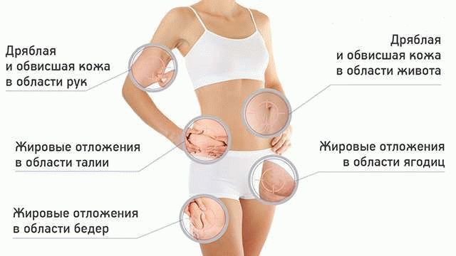 Лимфодренажный массаж в Тольятти от 1000 руб - дренажный массаж тела